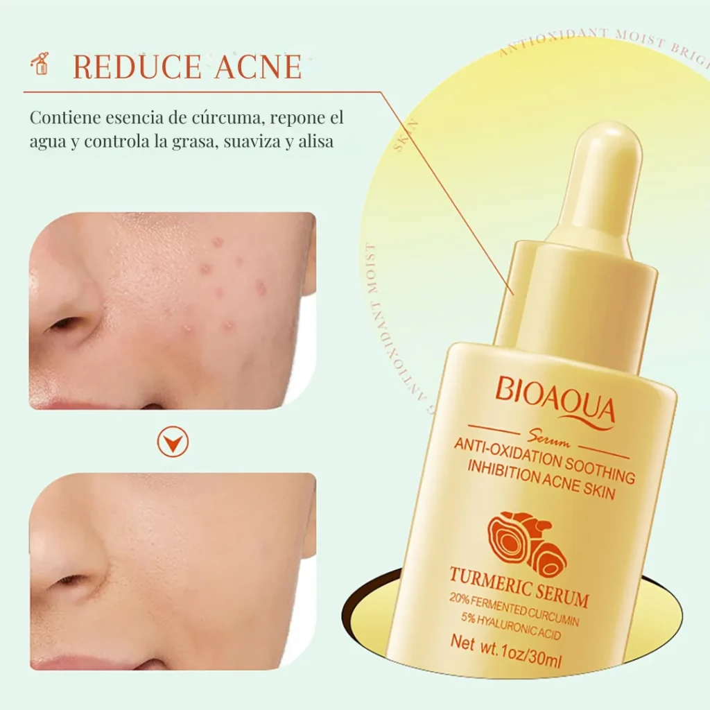 serum-acne